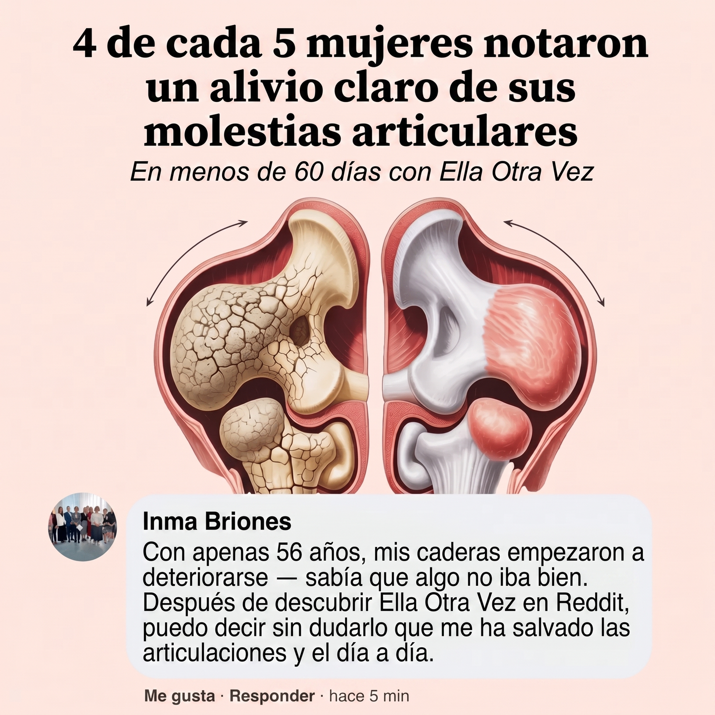 Ella Otra Vez